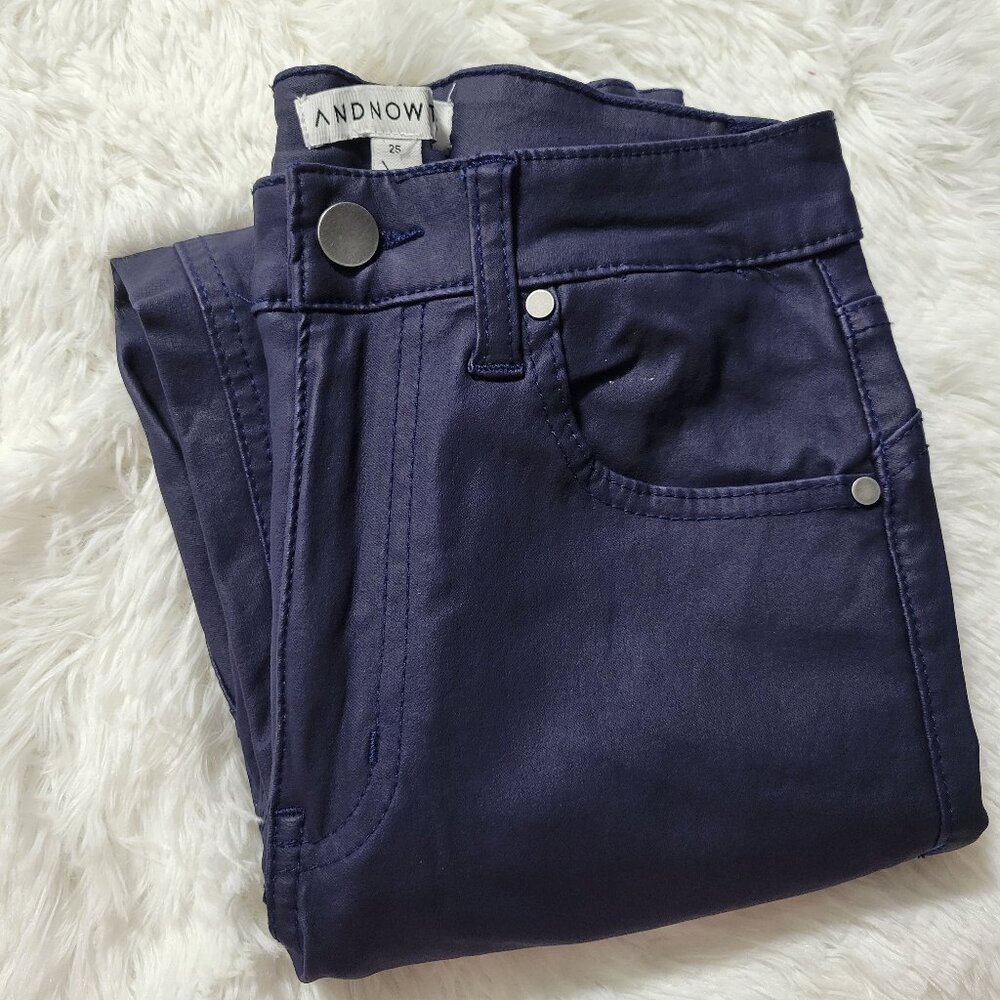 And Now This Blue Coated Skinny Jeans